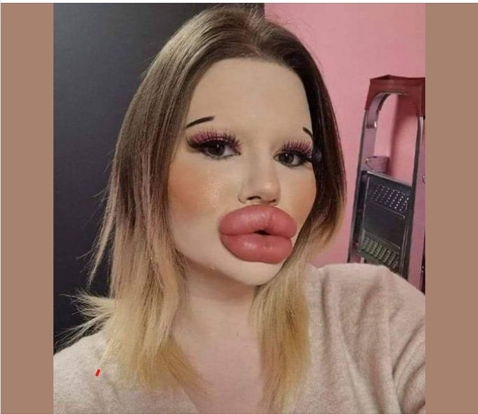 World Record Seeker The Woman With The Biggest Lips Dailywize 6055